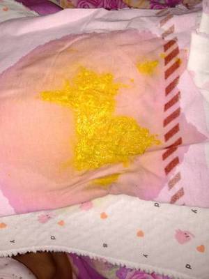 刚出生宝宝一天拉几次大便为正常