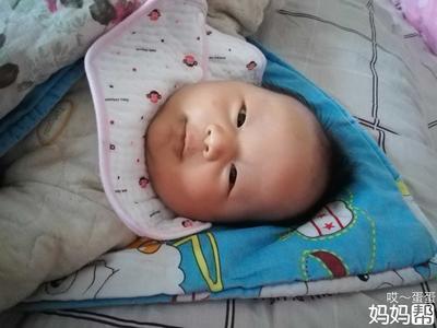 一个月的婴儿嗓子有痰怎么办