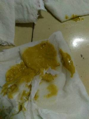 宝宝的便便有酸臭味