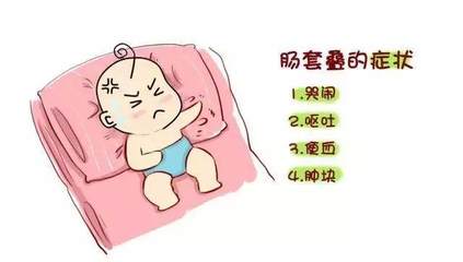 宝宝肠套叠症状