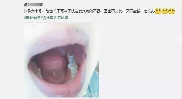 孕妇智齿疼怎么办