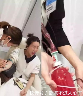换血美容