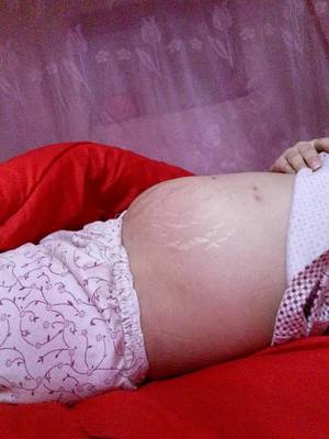 1岁宝宝肚子大正常吗