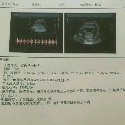 胎儿在左边