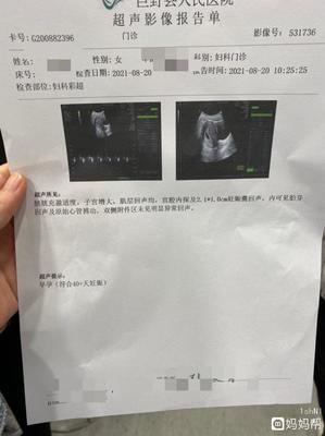 怀孕2个月最准看男女