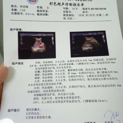 怀孕多久可以鉴定男女