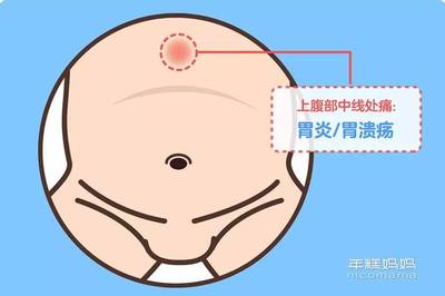 宝宝感染幽门螺旋杆菌