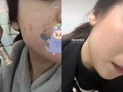 哪儿看痘痘好