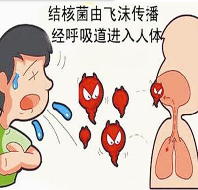 咳嗽的痰带血