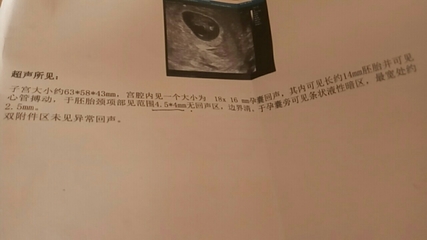 怀孕8周胎儿图片欣赏