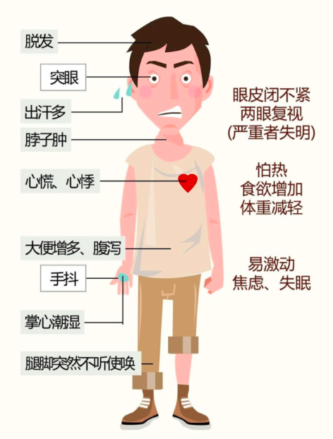得了甲亢怎么治疗