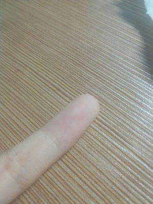 小拇指痛是怎么回事