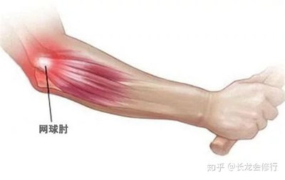 筋骨疼怎么治疗效果好