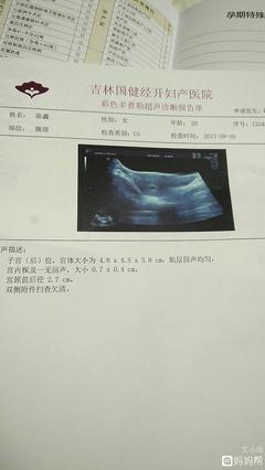 怎么确定是不是怀孕了