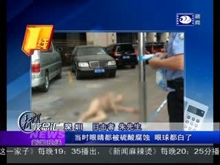 泼硫酸案件