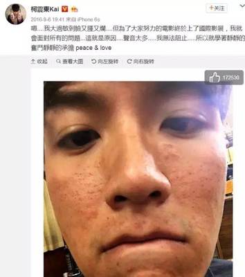 脸过敏痘痘
