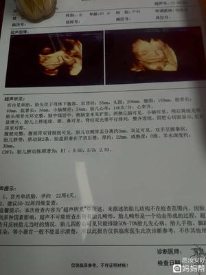 孕妇肾盂分离是什么意思