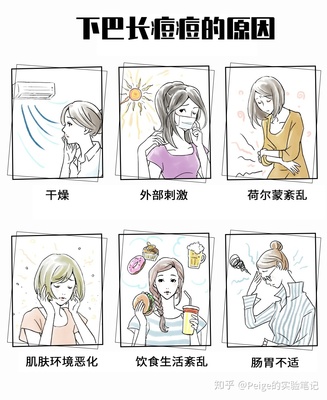 干燥环境最容易长痘痘