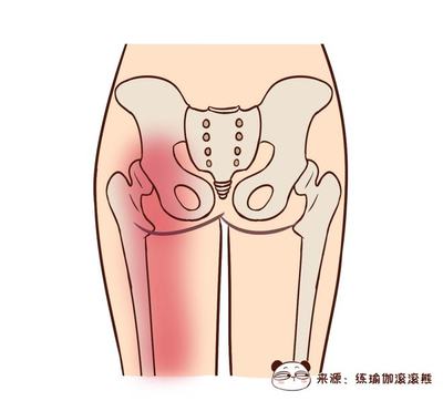 屁股中间痛是怎么回事