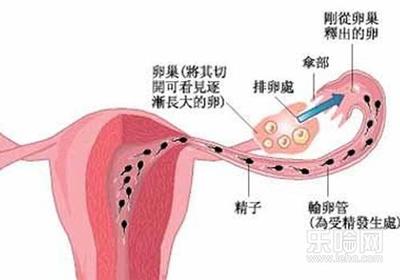 单侧输卵管怀孕的技巧