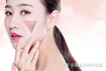 激光祛斑后可以化妆吗