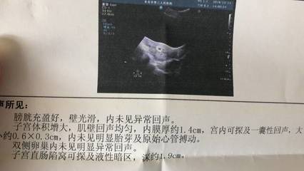一般几天会怀孕