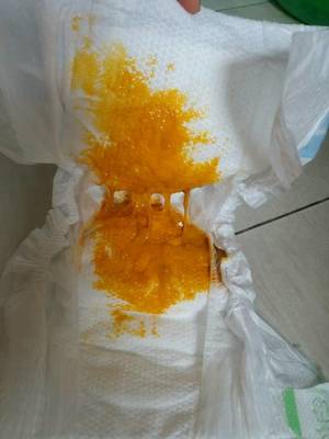 宝宝拉的粑粑黏糊糊的