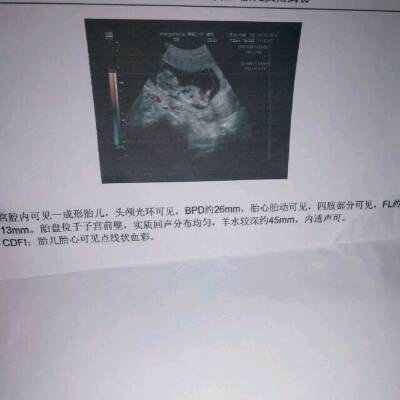 胎儿14周会有胎动吗