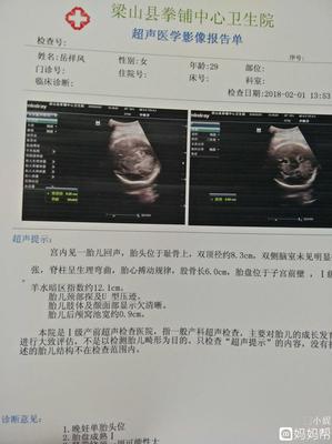 胎儿颅脑超声