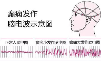 幻听怎么治疗才能好