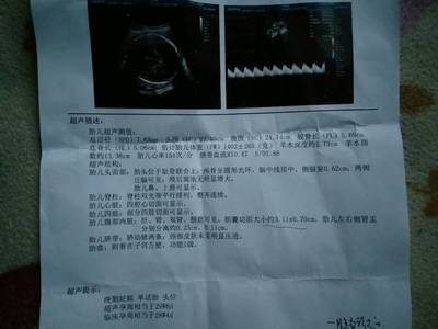怀孕6个月做什么检查