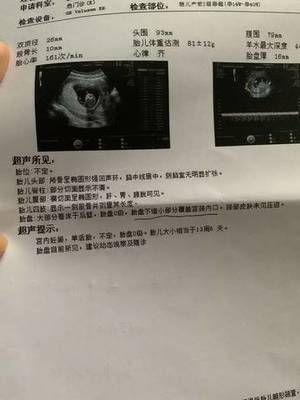 胎儿估算体重