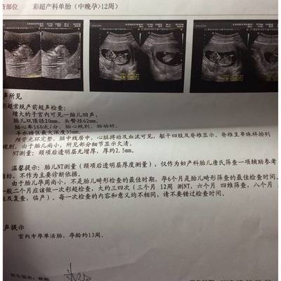 12周胎儿nt指数是多少正常值是多少