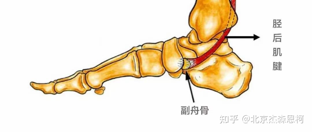 脚内侧疼是怎么回事