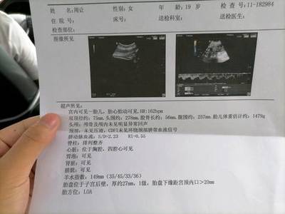 怀孕30周胎动频繁正常吗