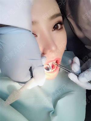 戴牙套能瘦脸吗