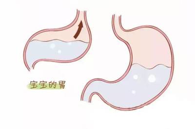 新生儿胃图片