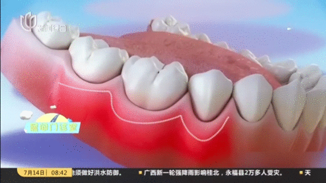 老年人牙齿委缩
