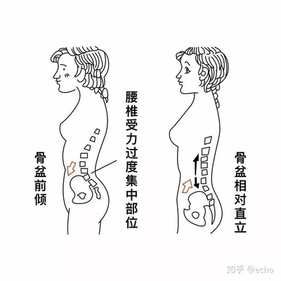 女生来大姨妈腰疼是怎么回事