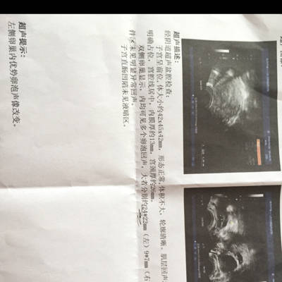 没有优势卵泡怎么治疗