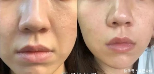 为什么要涂隔离霜