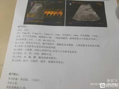 胎儿多少斤正常