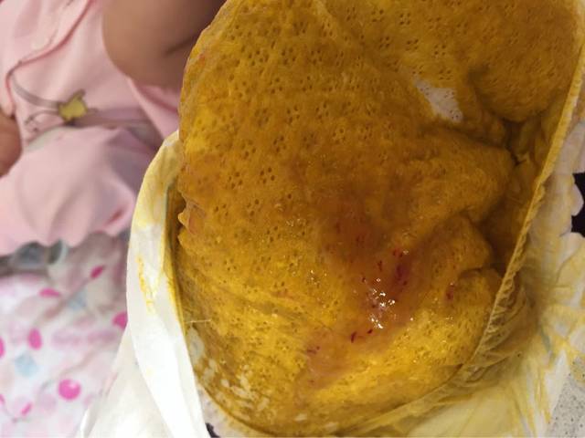 六个月宝宝大便有血丝