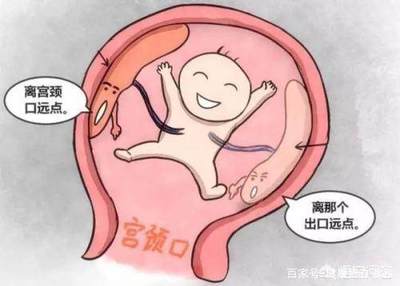 孕妇胎盘低是什么原因