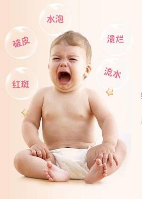宝宝屁股溃烂怎么办