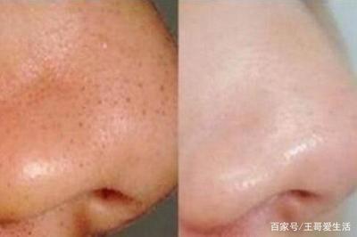如何使毛孔变细腻