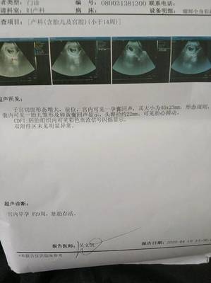 9周胎儿