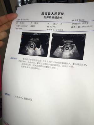 去医院检查是否怀孕要空腹吗