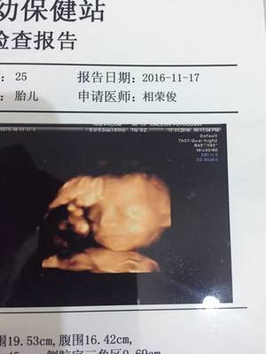 五个多月的胎儿有多大