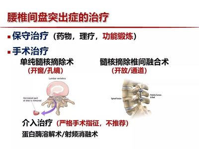 腰椎间盘突出怎么治疗最好